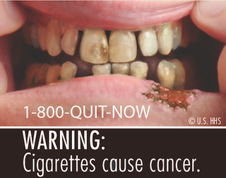 Illustration for article titled All the Disgusting Pictures the FDA Is Going to Put on Cigarette Boxes